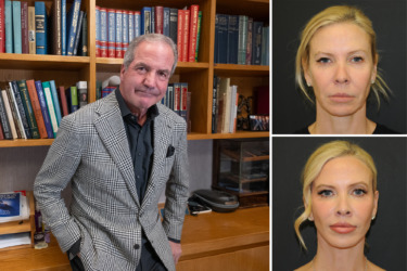 Relative beauty: NYC plastic surgeon operated on his entire family — and even gave his sister a boob job