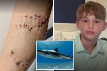 Boy, 12, saved by older brother after shark attack 60 miles offshore on Bahamas family vacation