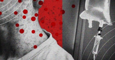 Measles Is Becoming So Common That Treatments May Soon Be Needed