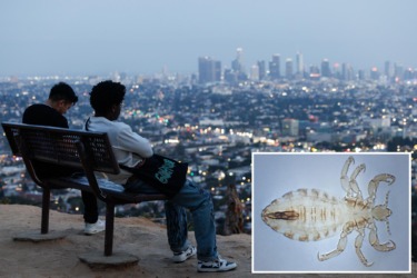 After typhus in LA, what’s next — bubonic plague?