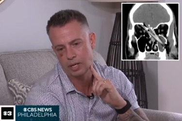 NJ dad miraculously survives after ‘huge’ tree branch impales his jaw into his brain: ‘Mind boggling’